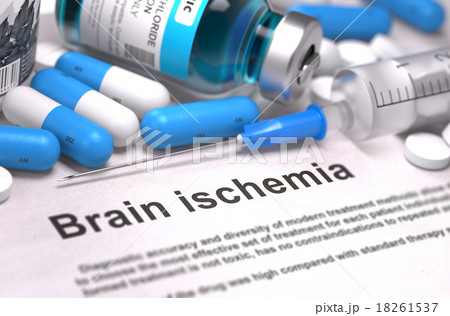 Brain Ischemia Diagnosis. Medical Concept 18261537