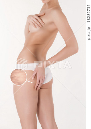 Woman pinches her thigh to control cellulite Woman pinches her thigh to control cellulite 18282732
