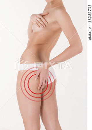 Woman pinches her thigh to control cellulite 18282733