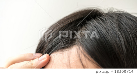 ヘア 18300714