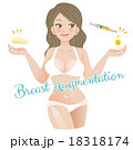 豊胸 Curvy Woman Breast Augmentation Concept 18318174