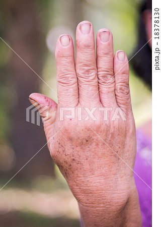 Back hand of old asian woman Back hand of old asian woman 18378130