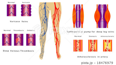 Vascular System Legs 18476979