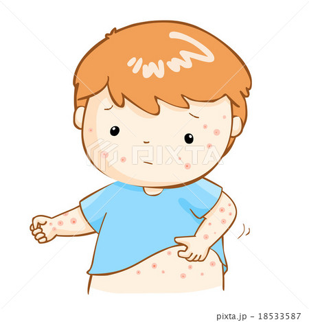 boy scratching itching rash on his body vector 18533587