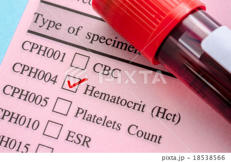 Hematocrit test blood. Hematocrit test blood. 18538566