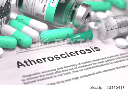 Atherosclerosis Diagnosis. Medical Concept 18550413