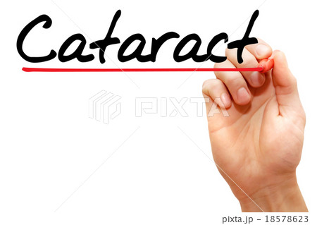 Cataract 18578623