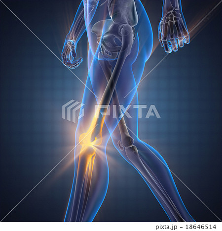 human bones radiography scan image 18646514