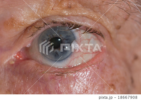 EYe exam EYe exam 18667908