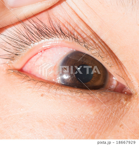 eye exam eye exam 18667929