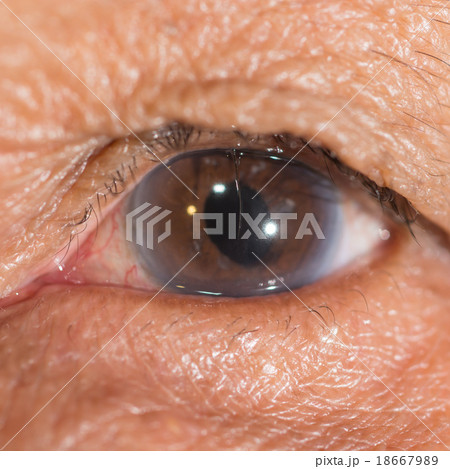eye exam eye exam 18667989