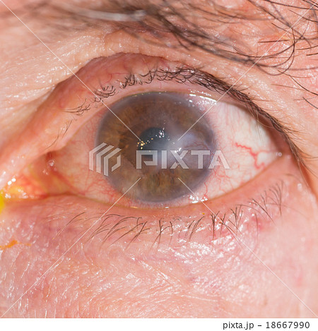 eye exam eye exam 18667990