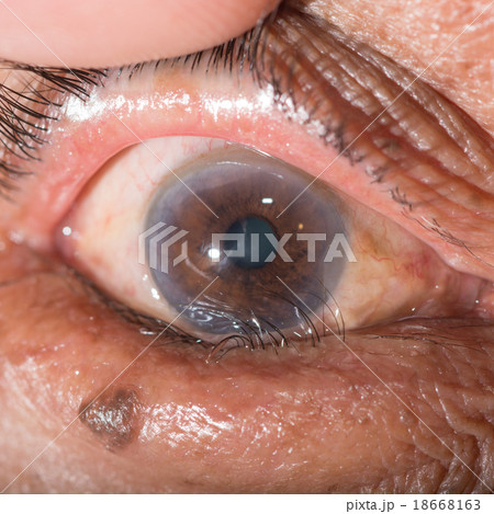 eye exam 18668163