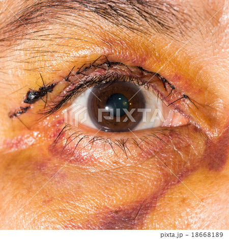 eye exam eye exam 18668189