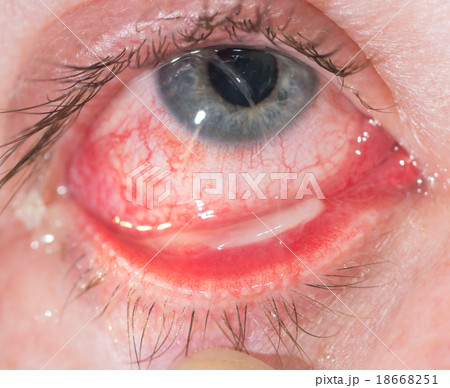 eye exam eye exam 18668251