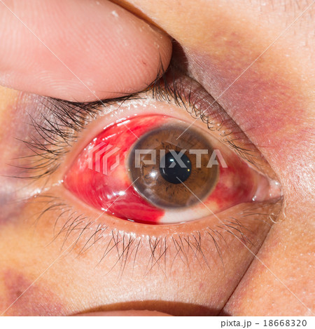 eye exam eye exam 18668320