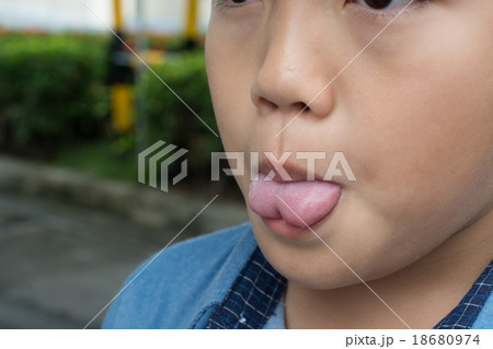 Tongue Tie 18680974