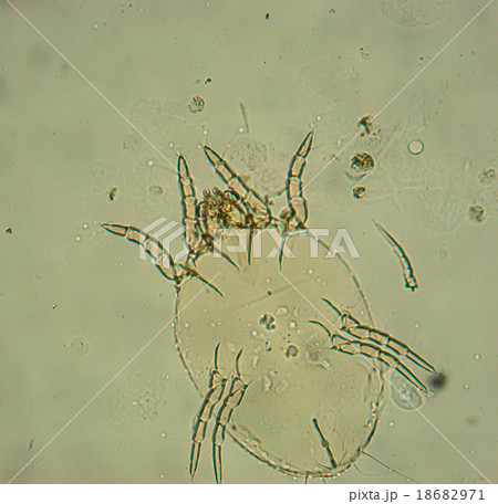 Human flea (Pulex irritans) Human flea (Pulex irritans) 18682971