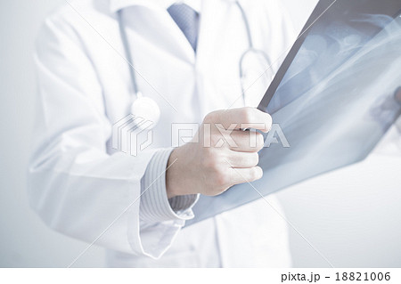 close up of male doctor holding x-ray or roentgen image close up of male doctor holding x-ray or roentgen image 18821006