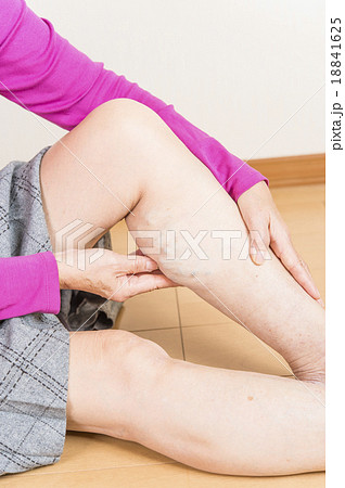 下肢静脈瘤 下肢静脈瘤 18841625