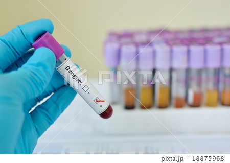 Dengue virus positive blood sample 18875968