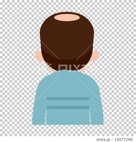 髪の悩み　抜け毛　はげ 18877266