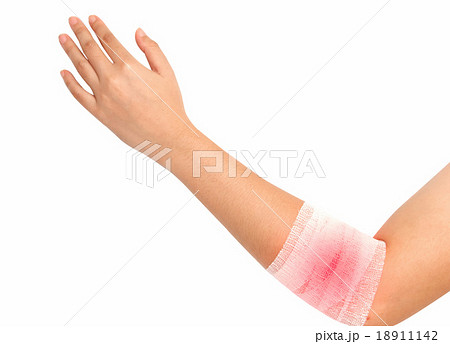 forearm and elbow injury ,strain in bandage forearm and elbow injury ,strain in bandage 18911142