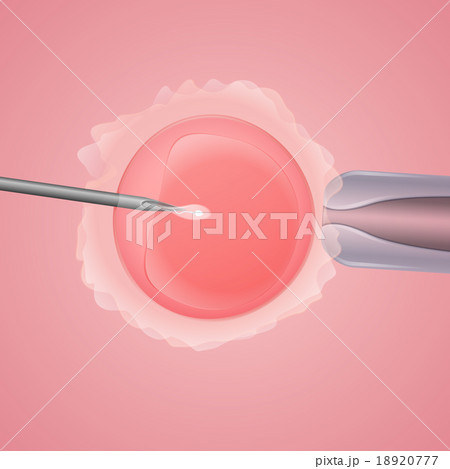 in vitro fertilization in vitro fertilization 18920777