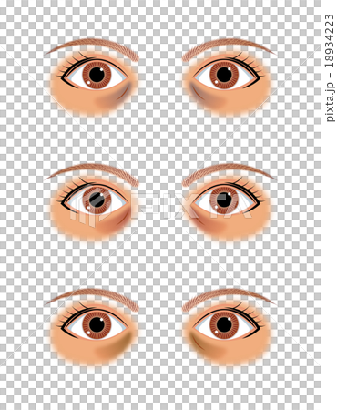 目の下のクマ 目の下のクマ 18934223