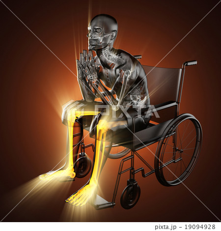radiography of man in wheelchair 19094928