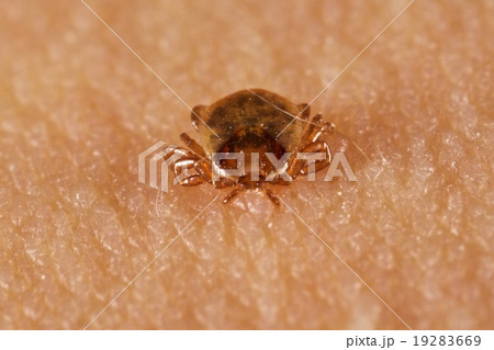 マダニ マダニ 19283669