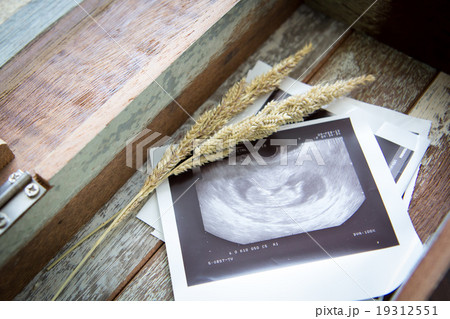 Memories of infant baby ultrasound Images 19312551