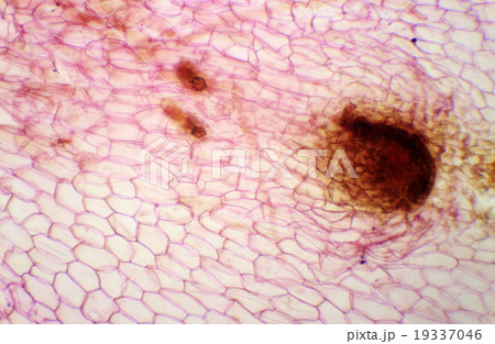 Micrograph of new sporophyte of fern leaf  19337046