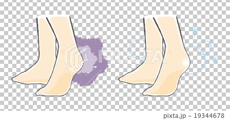 Before after illustration 19344678