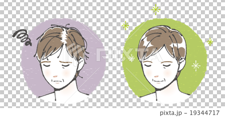 在受傷的頭髮(中年男子)的插圖之前 在受傷的頭髮(中年男子)的插圖之前 19344717