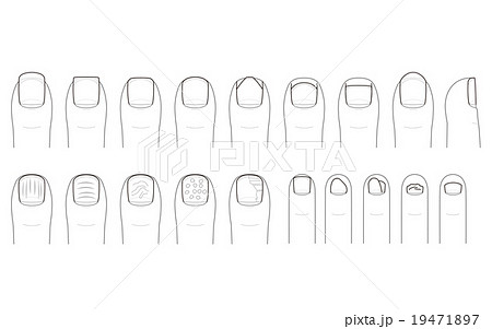 足の爪の切り方とトラブルのイラスト素材