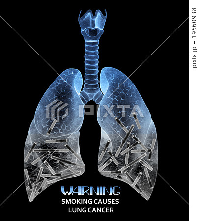 Watercolor  lungs full of cigarettes 19560938