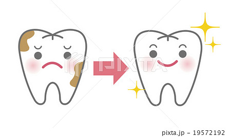 PMTC（歯の汚れ・歯垢・歯石除去イメージ） 19572192