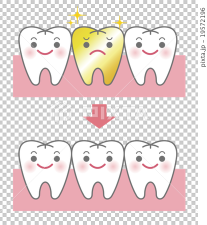 金歯とセラミックの比較イメージのイラスト素材