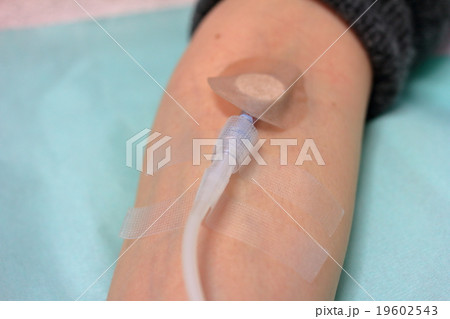 医療用の点滴 19602543