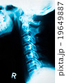 x-ray 1 19649887