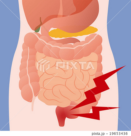 人間の消化器と腸炎 イメージイラストのイラスト素材