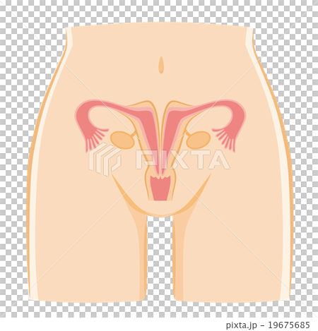 子宮畸形 子宮畸形 19675685
