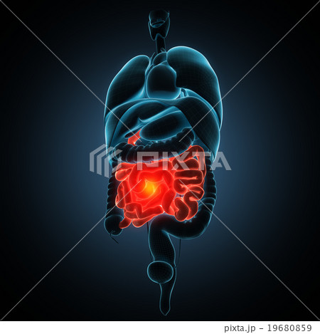 intestines disease illustration 19680859