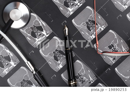 Series of images from a tomography 19890253