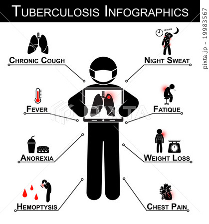 Tuberculosis ( TB ) Infographicsのイラスト素材 [19983567] - PIXTA