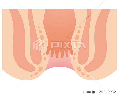 肛門 断面図 肛門 断面図 20040932