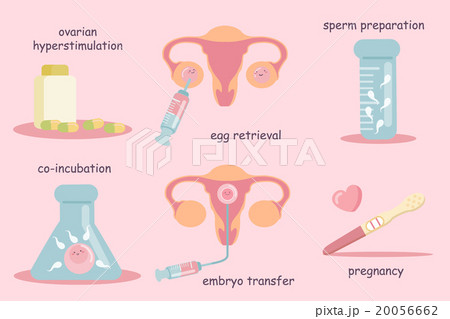 IVF concept 20056662