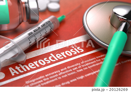 Atherosclerosis - Printed Diagnosis. Medical 20126269