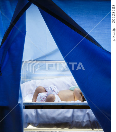 Neonatal Jaundice 20228288